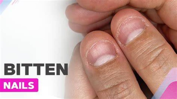 Are nail biters intelligent
