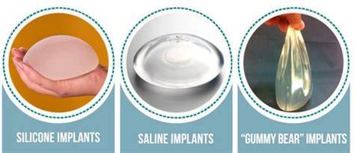 Are silicone implants toxic