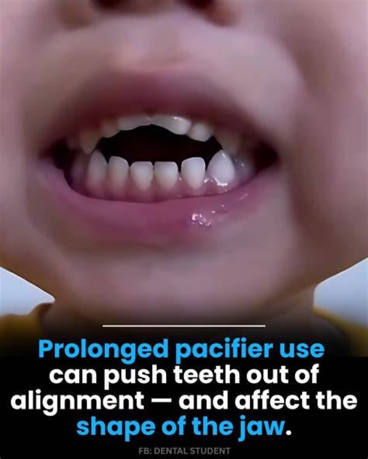 Can 3 week old use pacifier