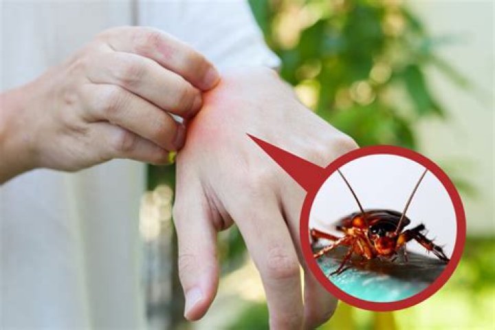 Can a cockroach bite a human