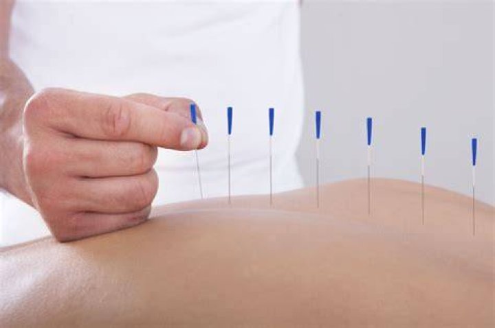 Can acupuncture cure itching