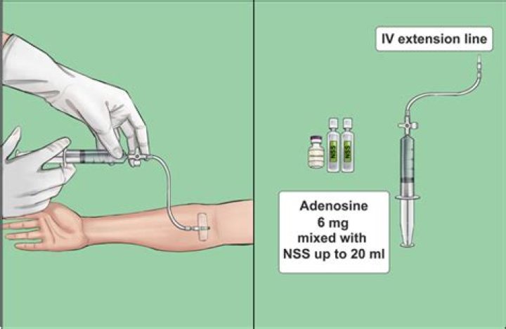 Can adenosine be used in WPW