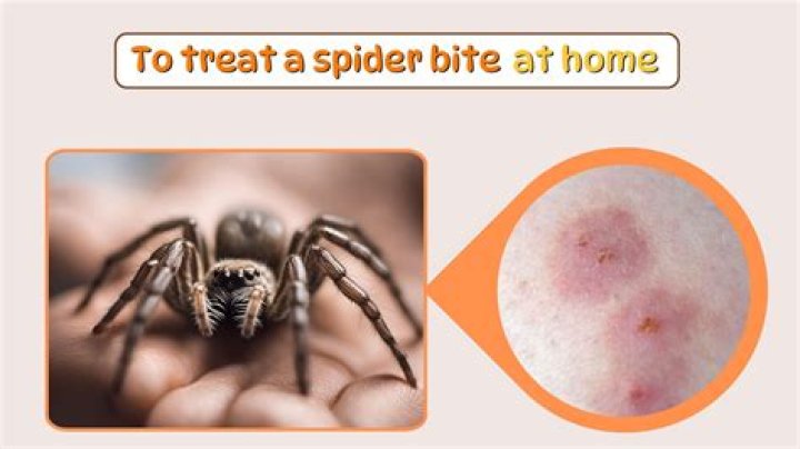 Can brown house spiders bite