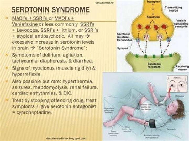 Can serotonin syndrome kill
