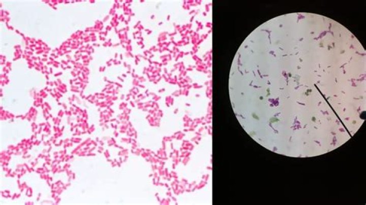 Can syphilis be Gram stained