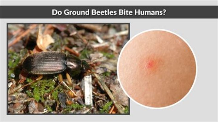 Do burying beetles bite