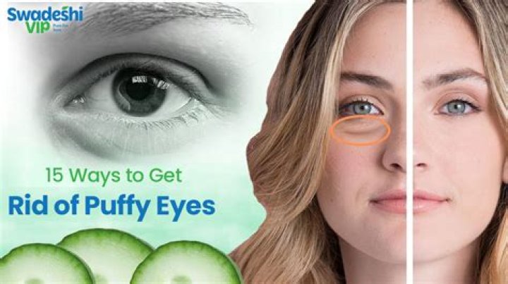 Do diuretics help puffy eyes