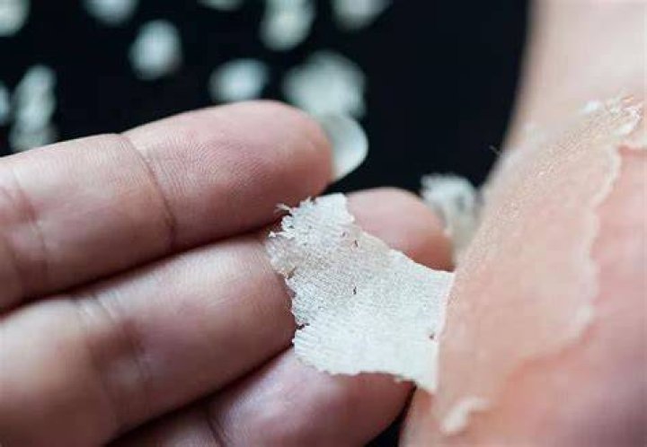 Do foot peels actually work