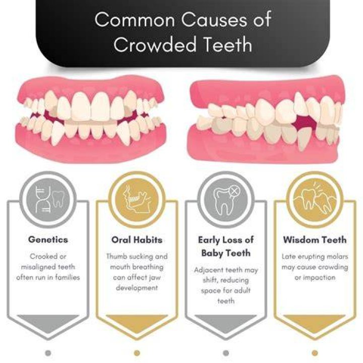 Do grills go over your teeth