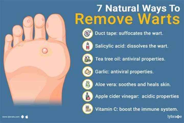 Do some warts never go away