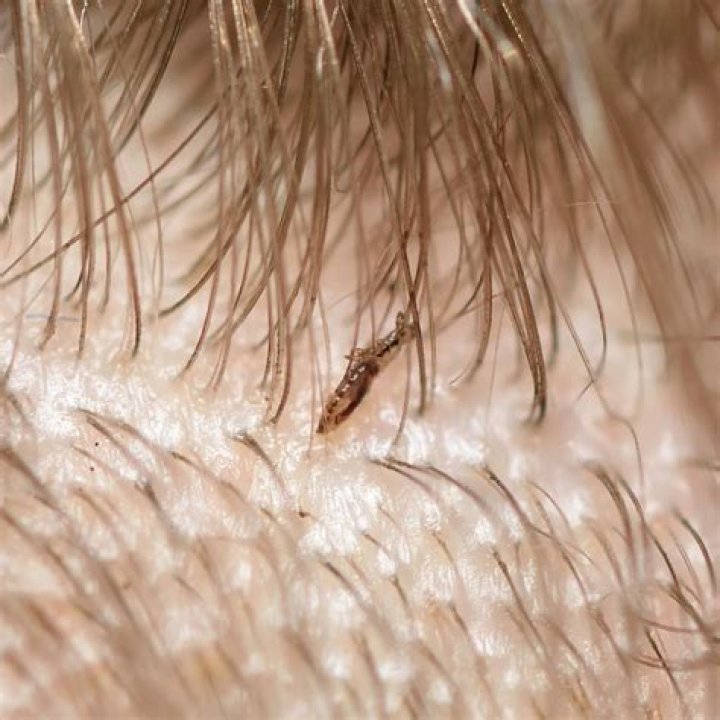 Does head hair hold bacteria