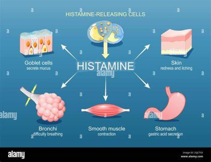 Does mast release histamine