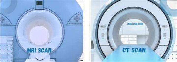 Does MetroPlus cover CT scan