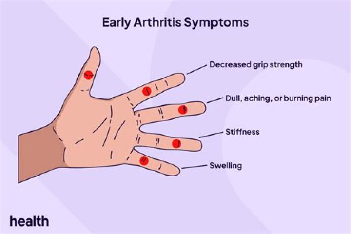 Does my child have arthritis