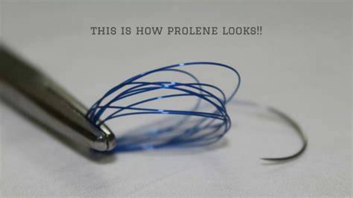 Does Prolene suture dissolve