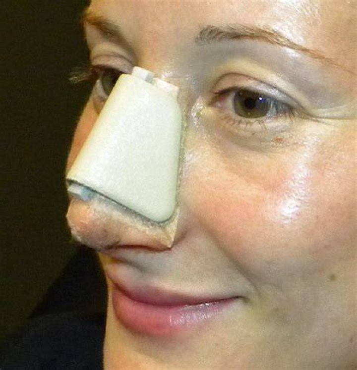 Does UHC cover rhinoplasty