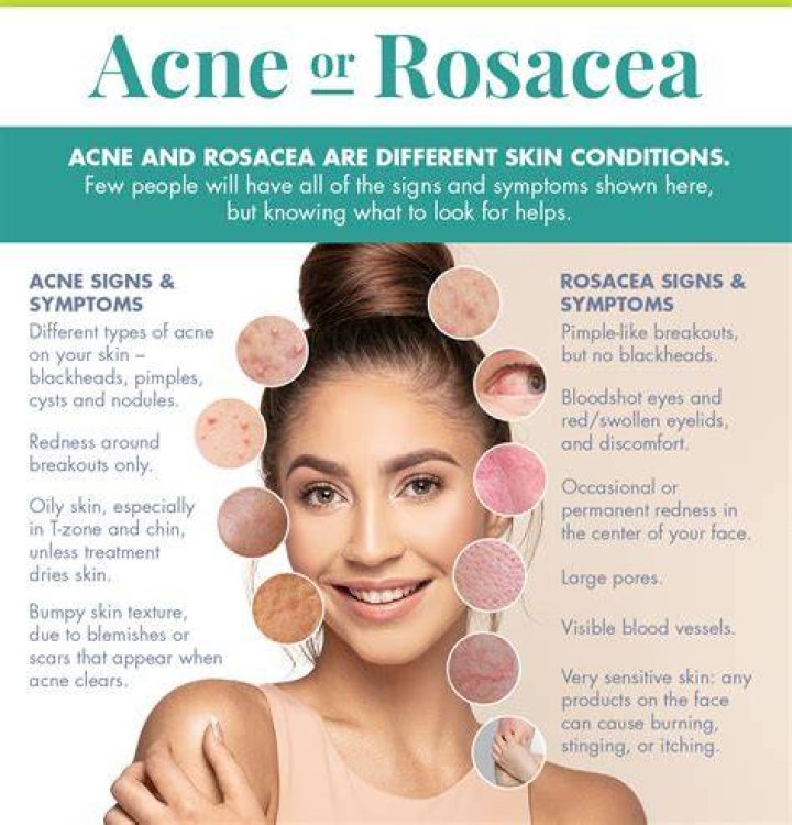 Does zinc help with rosacea