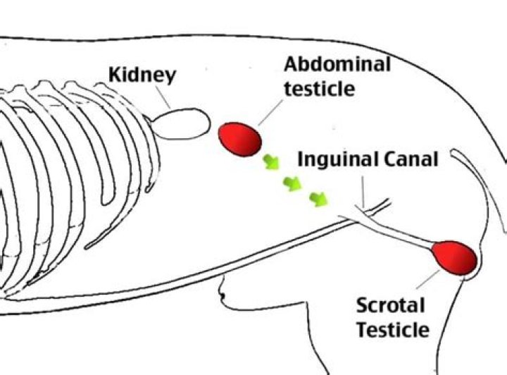 How common is cryptorchidism
