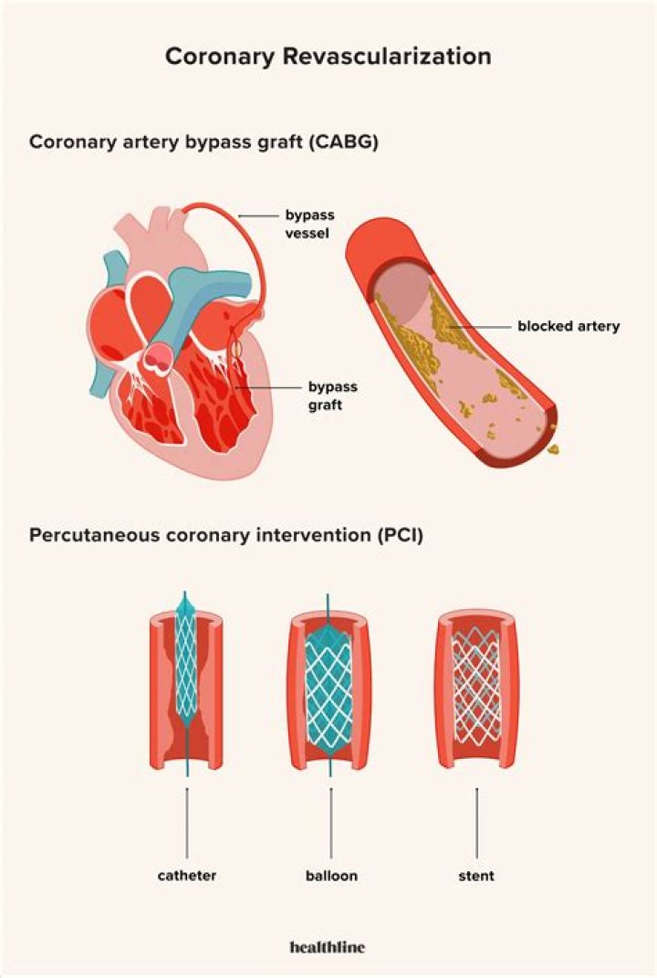 How common is recanalization