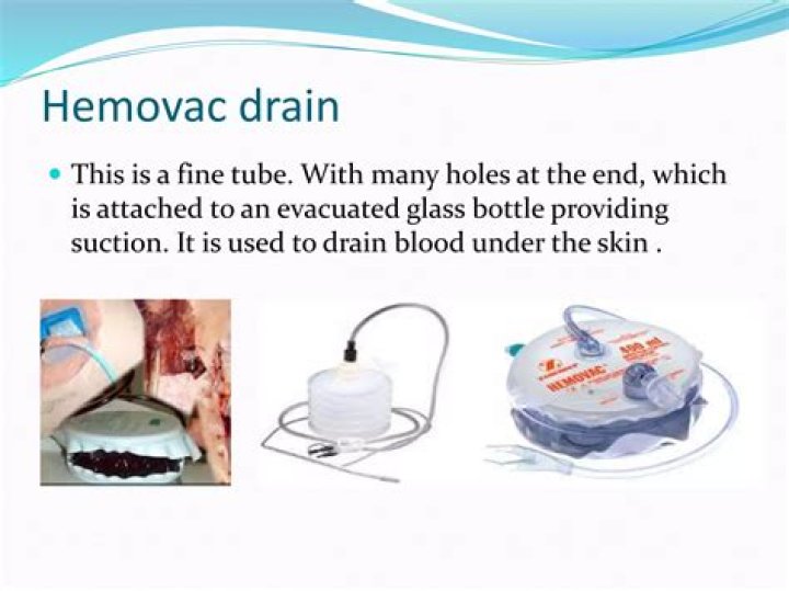 How do embalmers drain blood