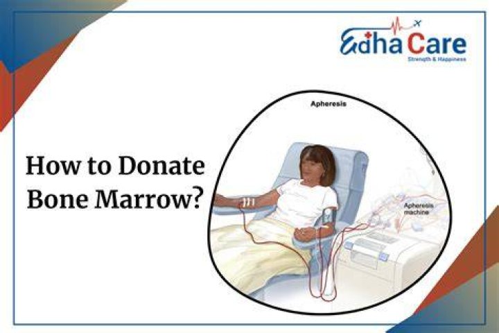 How do I donate a kidney car