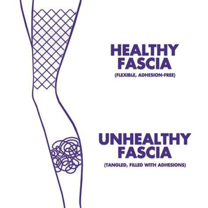 How do you break down fascia