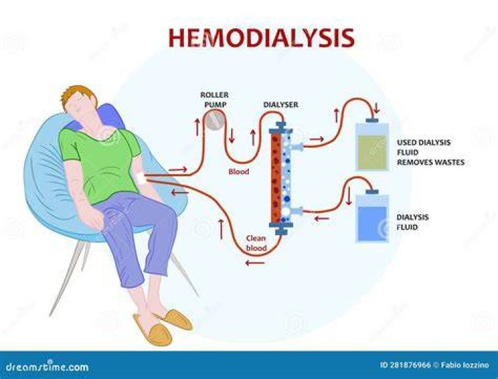 How do you code hemodialysis