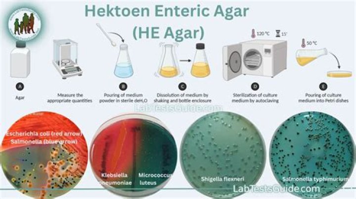 How do you identify Shigella