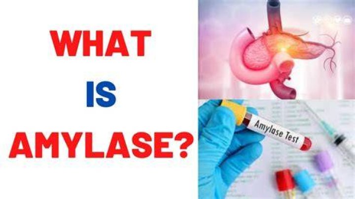 How do you test for amylase