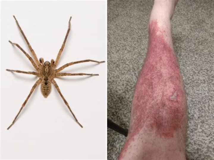 How does a spider kill a fly