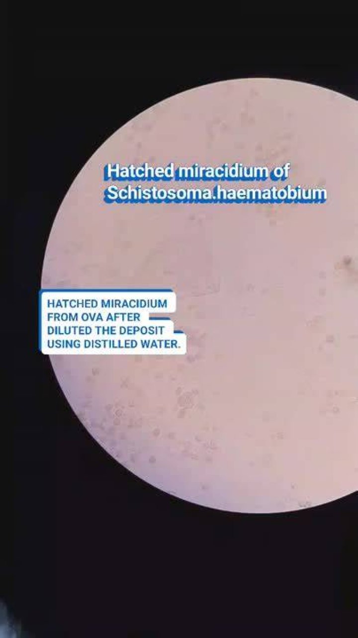 How does the miracidium move