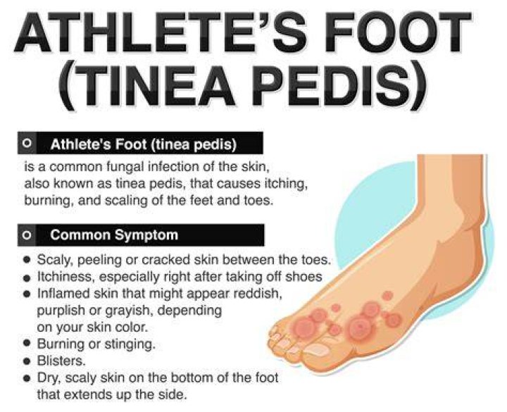 How does tinea pedis affect the body
