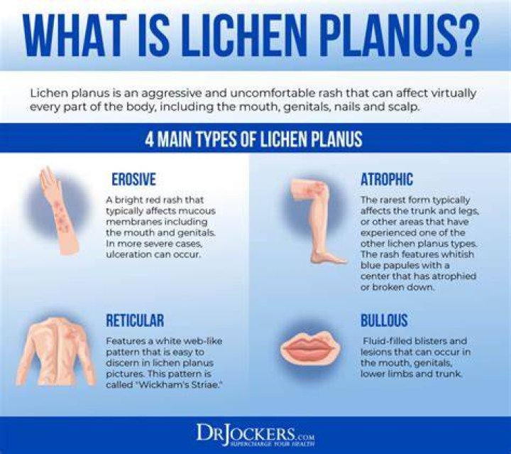 How fast does lichen spread