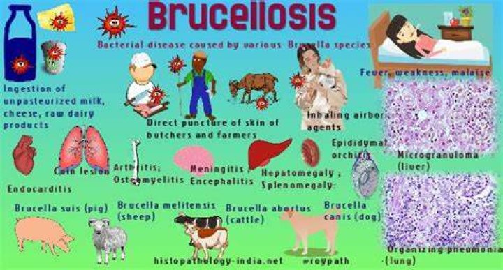 How is brucellosis diagnosed