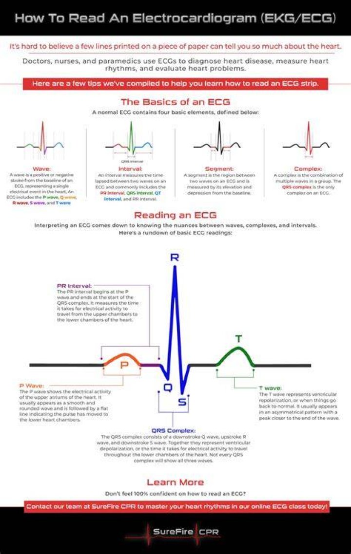How is ECG signal generated