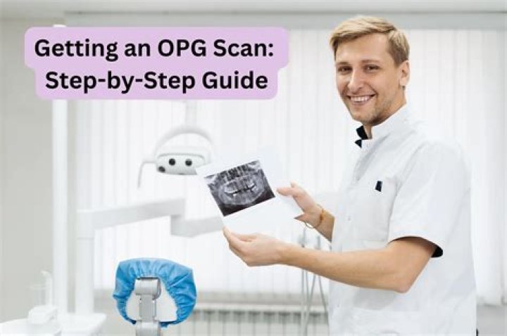 How long does OPG scan take