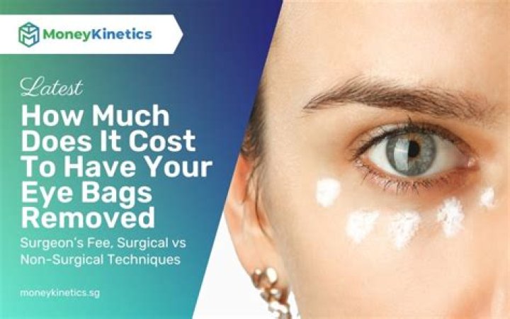 How much does eye drop cost