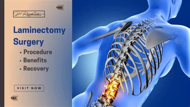 How serious is a laminectomy