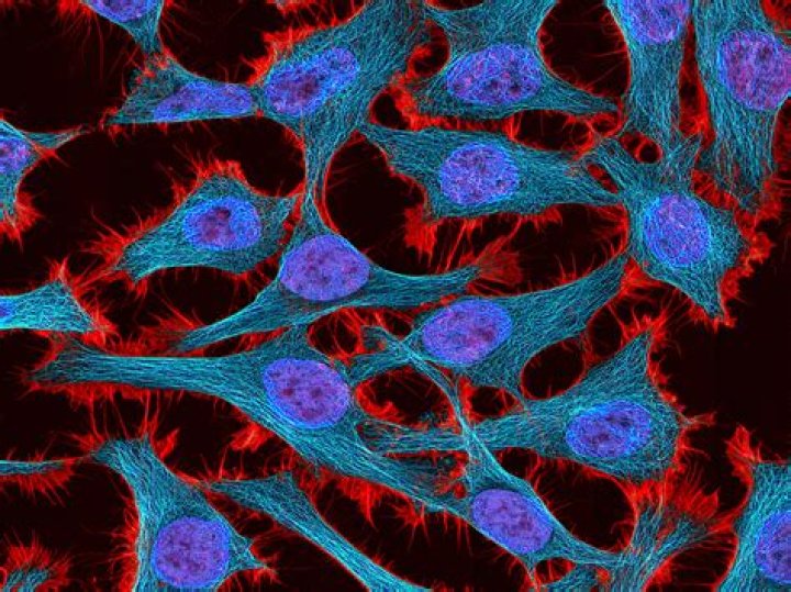 How were HeLa cells obtained