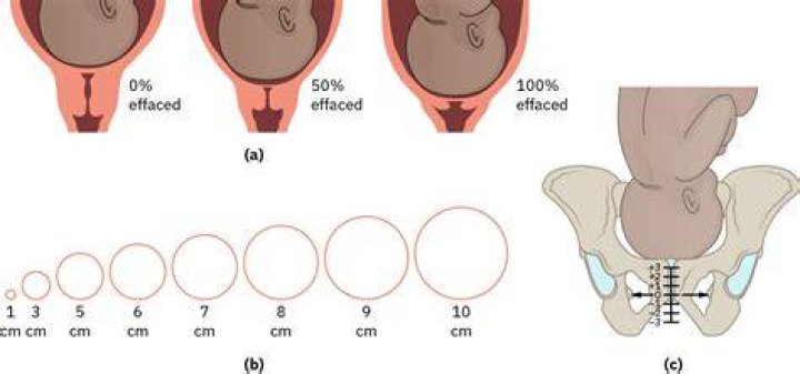 Is 4 cm dilated active labor