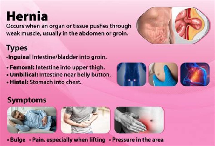 Is a bladder hernia serious