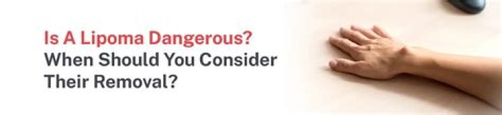 Is a lipoma dangerous