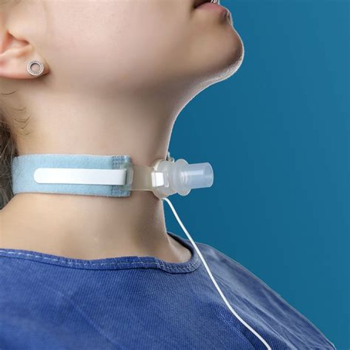 Is a trach collar permanent