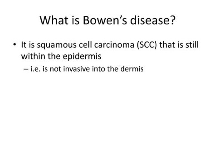 Is Bowens disease contagious