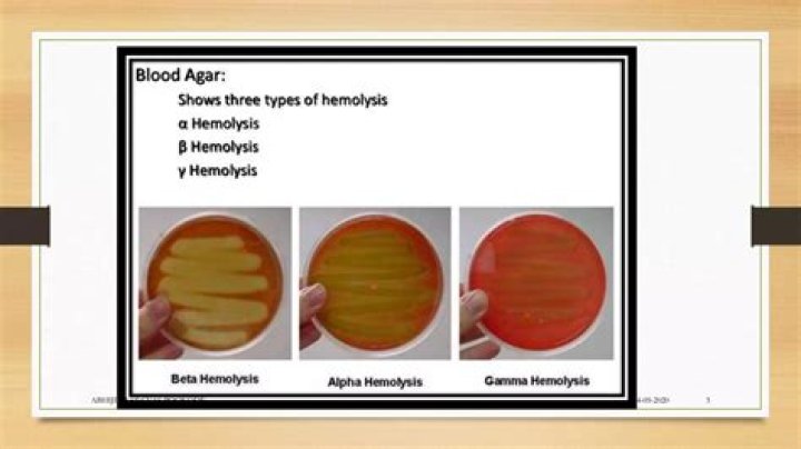 Is E. coli a gamma hemolysis