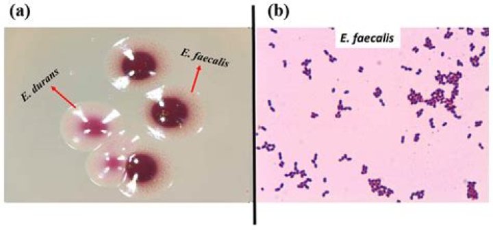 Is Enterococcus faecium VRE