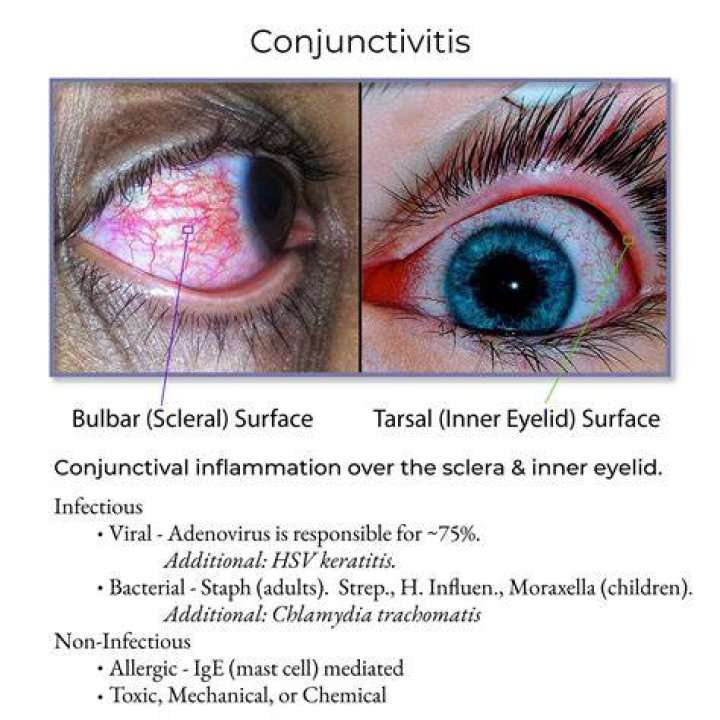 Is equine uveitis contagious