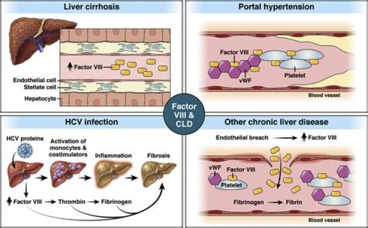 Is Factor VIII made in liver