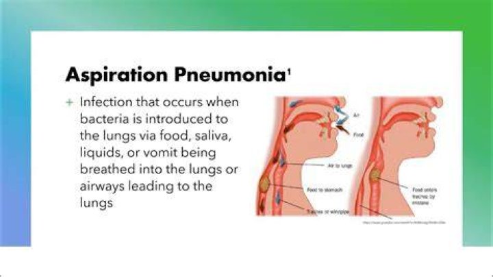 Is PNA the same as pneumonia