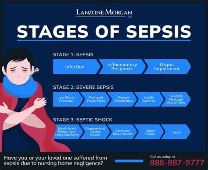 Is sepsis always coded first